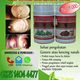 Illustration for article titled Obat Gonore Tradisional